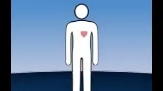 ESMR Treatment India | Heart treatment without bypass surgery  | Dr. Rahul Patil | Cardiospec
