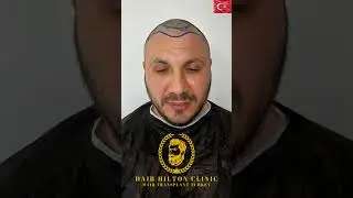 DHI SA&Ccedil; EKİMİ