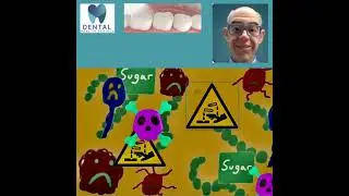 &ldquo;How to Avoid the Drill at the Dentist 🦷✨&rdquo; Use SDF @ the #dentist