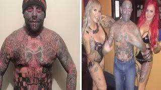 Man Covered In Tattoos To Cure Chronic Pain