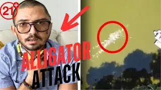 Florida man who survived alligator attack