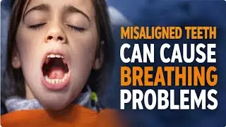 Misaligned teeth can lead to breathing troubles: Experts