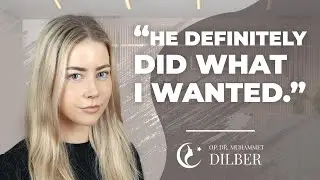 Nicole’s rhinoplasty experience with Dr Dilber