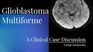 When Glioblastoma Does Not Look Like Glioblastoma: A Case of Diagnostic Delay