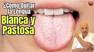 👅✨ &iquest;C&Oacute;MO QUITAR LA LENGUA BLANCA Y PASTOSA? 🤔🚿