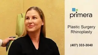 Rhinoplasty Helps Orlando Medical Assistant to Sleep, Breathe & Look Incredible | Dr. Edward Gross