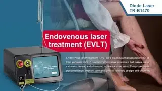 Diode laser 1470 nm spider vein removal machine TRIANGEL TR-B