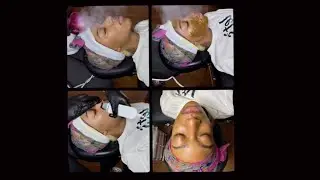 Blackhead/Whitehead facial extractions | best facials in Chicago| Allurefacialspaa