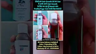 इस तेल से मेरे गंजे सिर मे बाल आ गए l🤩l Jamalgota for hair treatment #jamalgotahairtreatmentresult