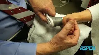 Laser Therapy Treatment on Plantar Fasciitis with Class IV Laser