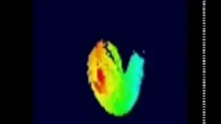 depth_estimation