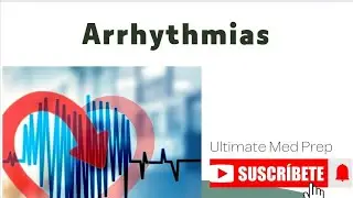 Arrhythmias | Causes | Classification #medicalstudies #usmle #heartdisease