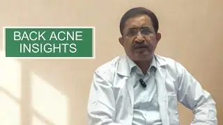 Back Acne Explained: Mistakes and Management by Dermatologist Dr. B.S. Chandrashekar