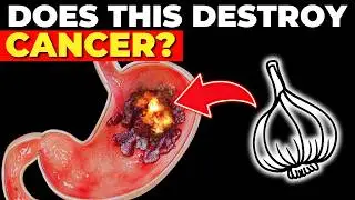 This is one of the BEST cancer fighting foods you can eat to PROTECT yourself (10 anti cancer foods)