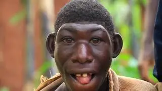 Born Different in Rwanda&mdash;The Real Story of Zanziman Ellie and the Truth Behind the &ldquo;Real-Life Mogli&rdquo;