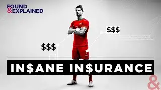 Insuring Body Parts - More Than Just Football