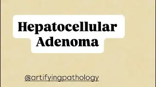 Hepatocellular Adenoma Explained with Storytelling | Pathology Made Visual