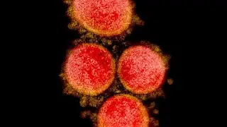 COVID-19 tests are key to stop the pandemic: How do they work? and how can you get one?