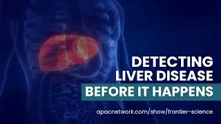 Detecting liver disease before it happens