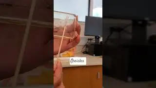 Ossicles of the Ear #anatomy #earanatomy