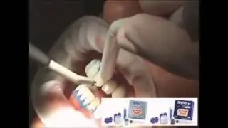 Professional Oral Care Perfect White LIQUID & POWER PLUS