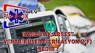 EKG - ÖLÜMCÜL RİTİMLER : VENTRİKÜLER FİBRİLASYON 'a yaklaşım nasıl olmalıdır ?