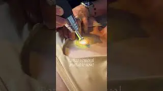 Heart Tattoo Removal from Chest at Alternative Laser Health | Safe Laser Treatment