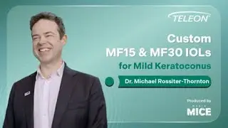 Dr. Michael Rossiter-Thornton: Custom MF15 & MF30 IOLs for Mild Keratoconus