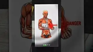 Bone Broken? 🚨 Do THIS Immediately! (First Aid) #shorts #viral #health #BoneFracture #MedicalShorts