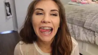 Braces & Rubberbands Video of Bracefacebeauty Victoria