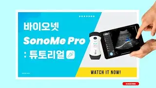 SonoMe Pro 사용 방법