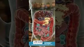 Permanent Cure for Acidity & Constipation? | Gut Health Secrets #guthealth  #acidity  #shorts