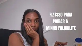 ERROS QUE PIORARAM MINHAS MANCHAS (HPI em pele negra) 🛑 N&atilde;o fa&ccedil;a isso! #serieHPI #2 