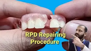 Removable partial denture repairing ||How to repair a broken partial dentur || Dental Art by Haider.
