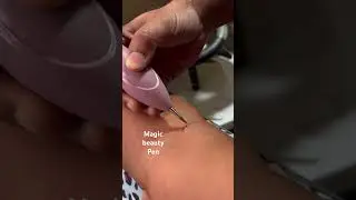 Watch skin tags vanish painlessly with the Veentus Wart Remover Pen! Say goodbye to pesky moles !