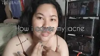 How I cover my acne & dark spot | Combo Oily Skin #ziselbeauty
