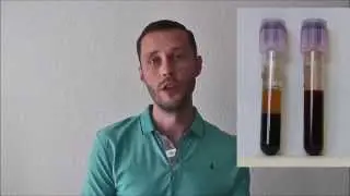 Blutgasanalyse: Fehlerquellen bei der Abnahme