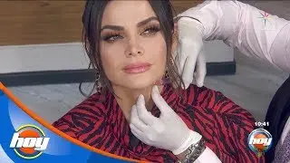 Marisol Gonz&aacute;lez se une al tratamiento para evitar el envejecimiento del cuello | Hoy
