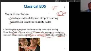 Ehler Danlos Syndrome: Collagen (Extracellular Matrix) disorders-2 USMLE Step1