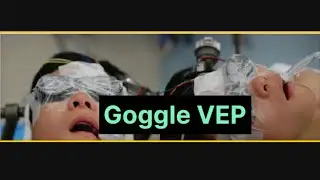 Goggle VEP /FLASH VEP -visual evoked potential