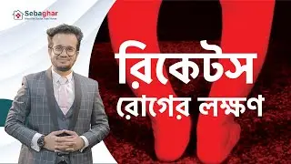 অস্টিওম্যালাসিয়া বা রিকেটস রোগের লক্ষণগুলো কি কি এবং শিশুদের রিকেটস রোগের চিকিৎসা পদ্ধতি - Sebaghar