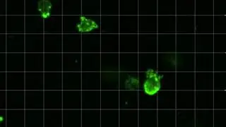 Invasive breast cancer cells push through &lsquo;tissue&rsquo;