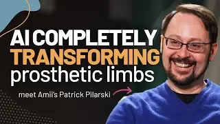 AI is transforming prosthetic limbs: Meet Amii's Patrick Pilarski