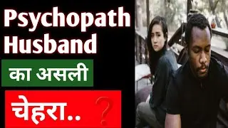 Psycho path Husband- का असली चेहरा कितना क्रूर..‼️|BY:Dr. Dwarka 