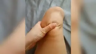 Amputee Girl Checking Up STUMP Health | AK BK Amputee Lady