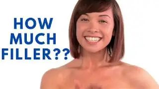 Lip Filler -  How much is enough?