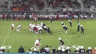 Quick trap off midline 2