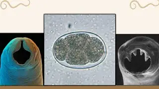 Hookworms Photo Compilation with Captions (Medtech Study Guide)