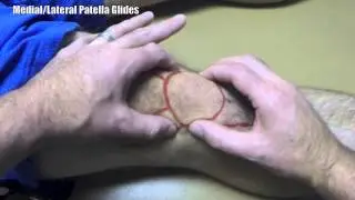Patellofemoral Mobilization