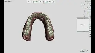 Orthodontic treatment HOSDENT ALBANIA (Rİ) 